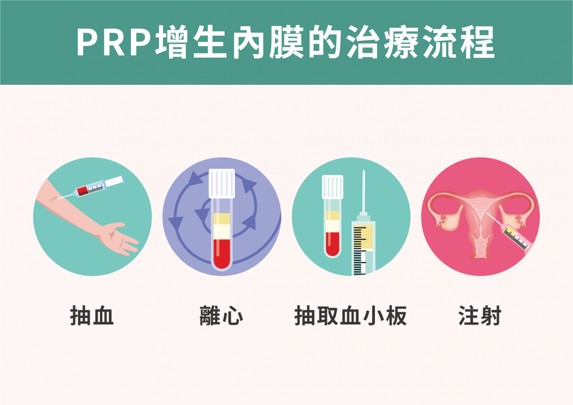 PRP療法治療流程