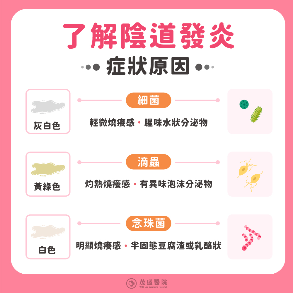 陰道炎類型及症狀