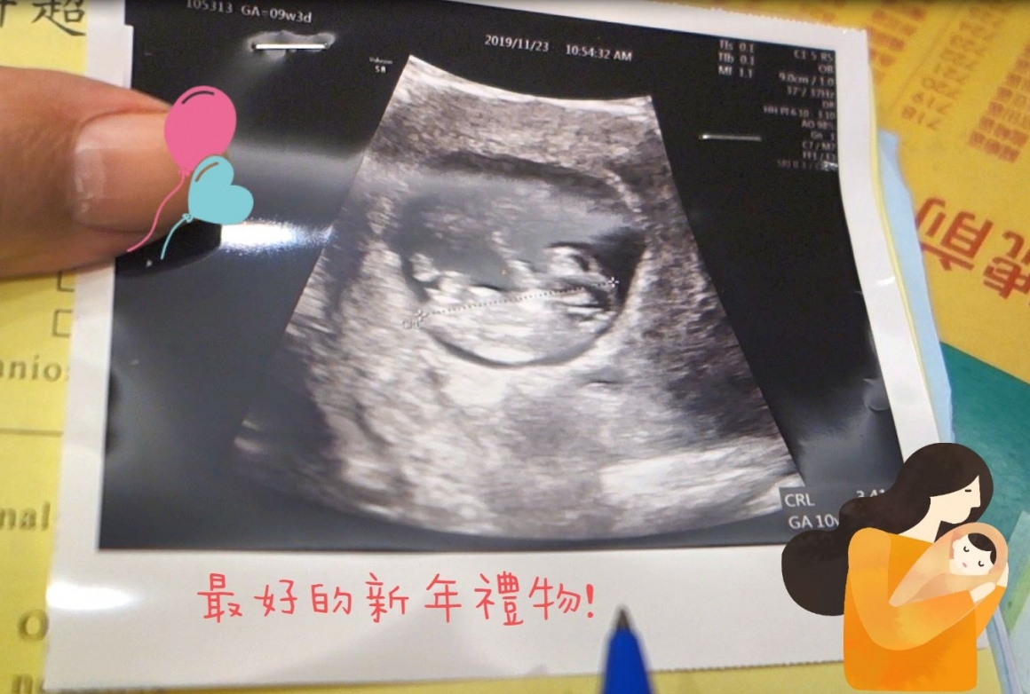 20200130 茂盛醫院生殖醫學中心-成功案例-20200130