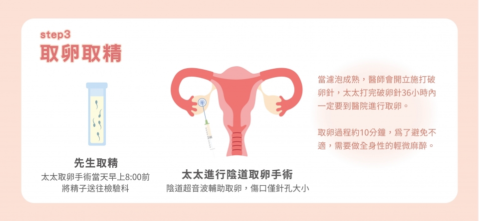 凍胚流程步驟3:取卵取精 凍胚流程步驟3:取卵取精