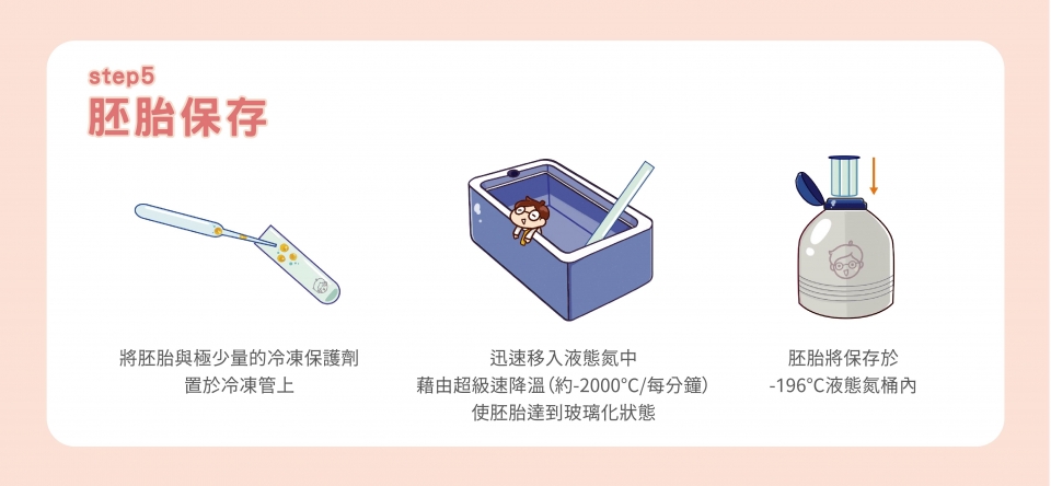 凍胚流程步驟5:胚胎凍存 凍胚流程步驟5:胚胎凍存