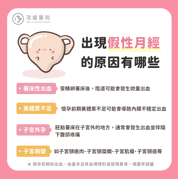tw_news_list_23j16_jw688csqt5 假性月經的原因