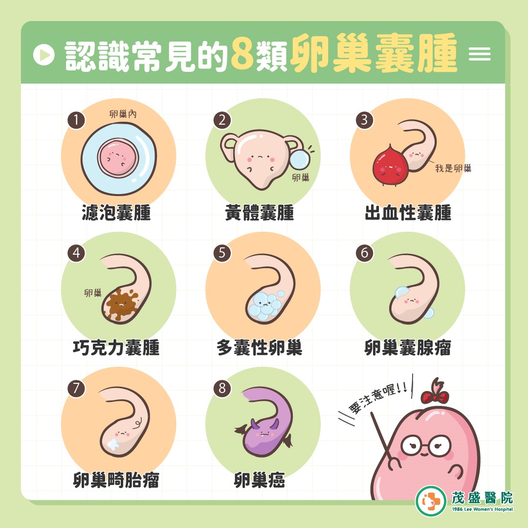 卵巢囊腫種類 卵巢囊腫種類