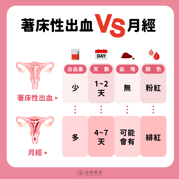 懷孕前兆出血與月經的不同 懷孕前兆出血與月經的不同