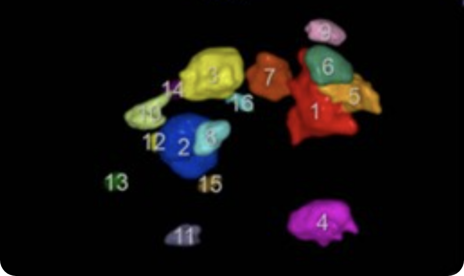 editor-8 4D 超聲波