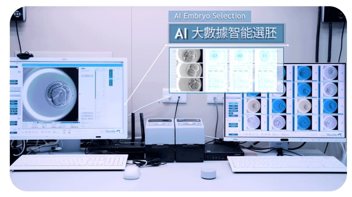 AI智慧選胚技術 - 茂盛醫院